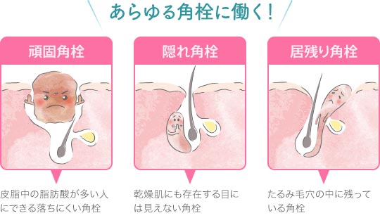 �}�C�N���p��